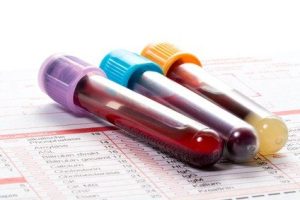 Blutproben liegen auf einem Laborformular zur Festellung der Blutwerte