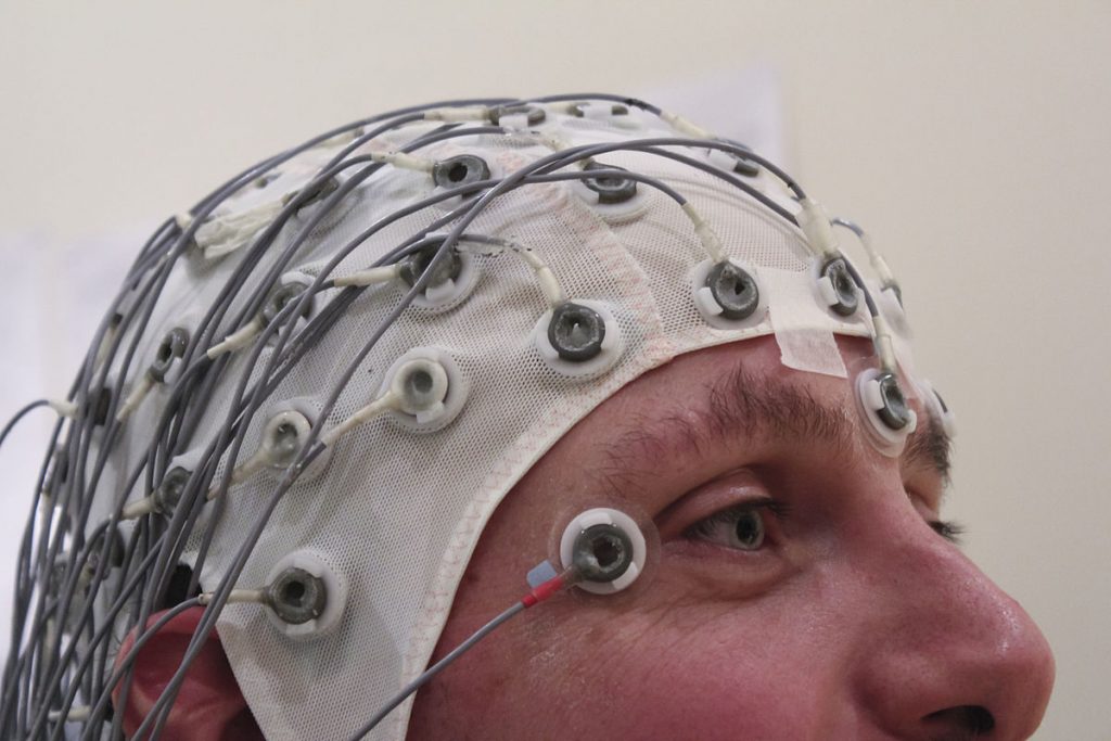 EEG Wikipedia 1200px-EEG_Recording_Cap