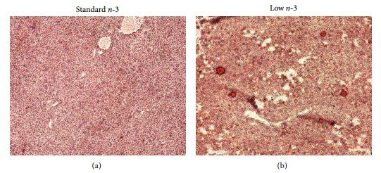 Mikroskopisch-Histologisches Präparat einer normale Leber und rechts daneben die geschwollene, kranke Fettleber im Vergleich bei den Mäusen, die ganz gleich ernährt wurden ausser mehr Raps- oder mehr Sonnenblumenöl