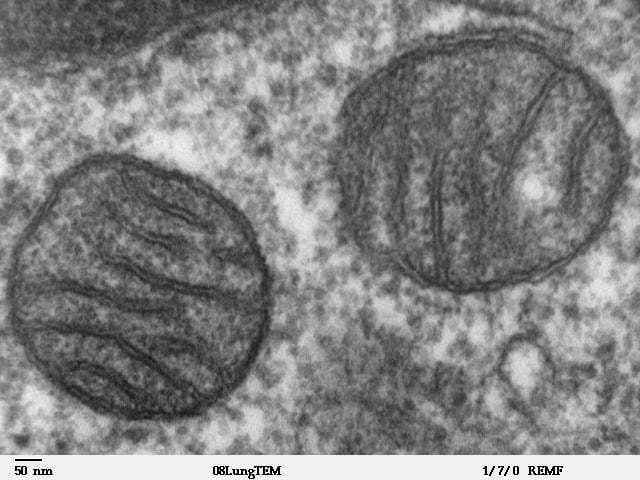 Mitochondria_mammalian_lung_-_TEM-Wikipedia